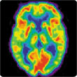 BlatantNews.com image of a human brain under creative commons