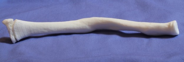 3D Printed Bone Model