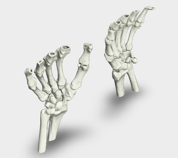 A 3D rendering of the bone structure of the hands
