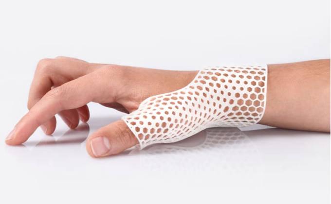 medical 3d printing applications for orthoses and prostheses