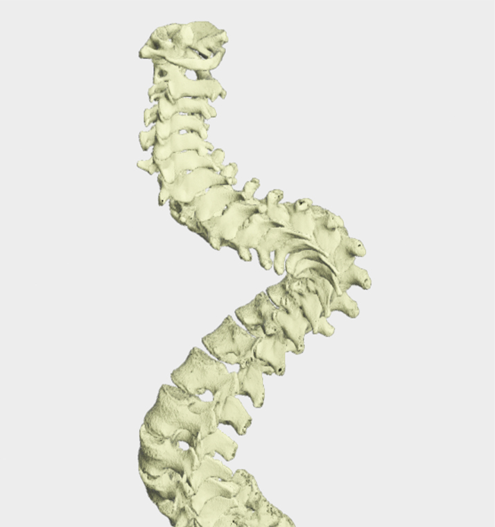 3D Rendering-Spine